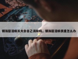 银渐层泪痕长大会自己消除吗，银渐层泪痕很重怎么办